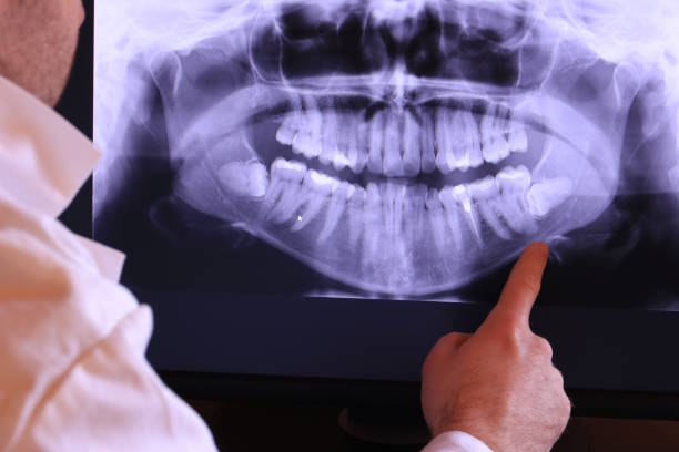 Best Dental Abscess Treatment in Quincy, WA